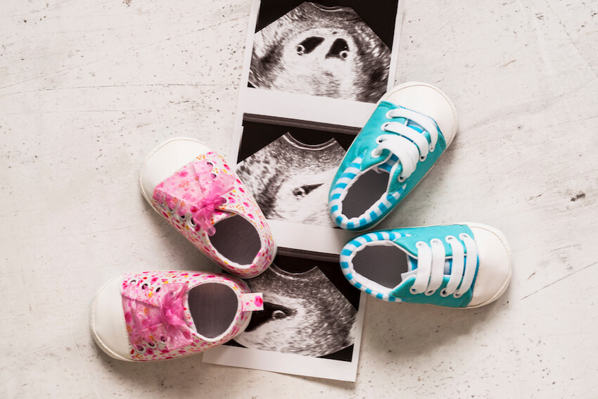 Twin pregnancy announcement: ultrasound pictures of twins and 2 pairs of baby shoes